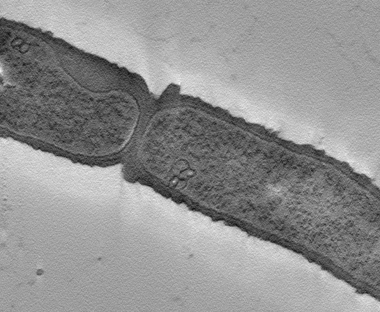Das stäbchenförmige Bacillus subtilis weist üblicherweise eine Größe von ca. 2 bis 3 Mikrometer auf (Aufnahme: © AG Stülke, Göttingen)