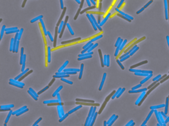 Bacillus subtilis - das Topmodel unter den Bakterien (Aufnahme: © Diethmaier, Stülke et al, Göttingen)