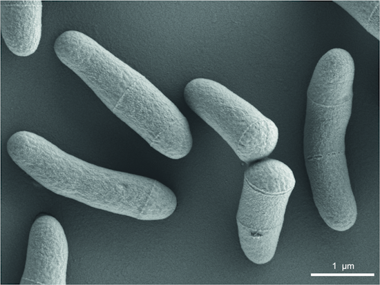 Corynebacterium gultamicum im Rasterelektronenmikroskop. Aufnahme: © Urska Repnik, Universität Kiel)