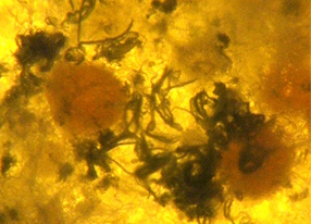 Mikrobe - Fruchtkörper - Kleistothezien (Aufnahme: © Ulrich Kück) Mikrobe - Fruchtkörper - Kleistothezien (Aufnahme: © Ulrich Kück)
